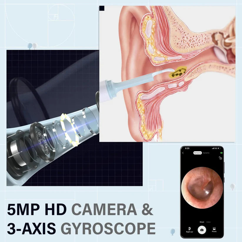 Gadgetsaga  - Visual Smart Ear Cleaner