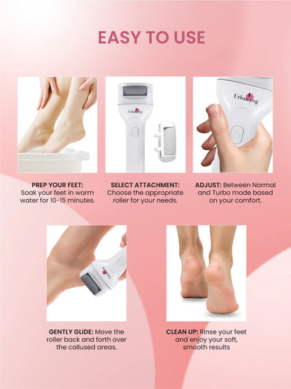 Foot Callus Remover